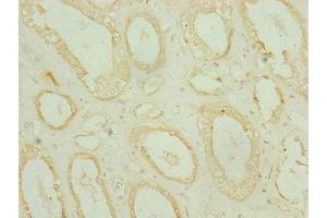 Immunohistochemistry of paraffin-embedded human kidney tissue using ABIN7159686 at dilution of 1:100 (CHCHD3 抗体  (AA 1-227))