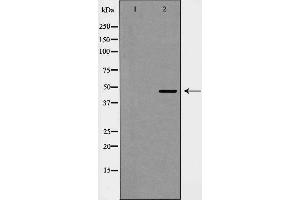 Western blot analysis of Cyclin E2 expression in COLO cells. (Cyclin E2 抗体  (C-Term))