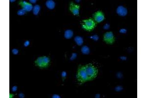 Immunofluorescence (IF) image for anti-IlvB (Bacterial Acetolactate Synthase)-Like (ILVBL) antibody (ABIN1498879) (ILVBL 抗体)