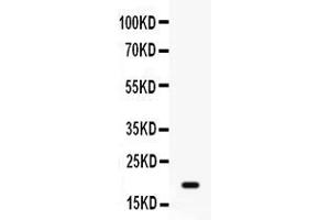 Western blot analysis of GADD45A expression in MCF-7 whole cell lysates ( Lane 1).