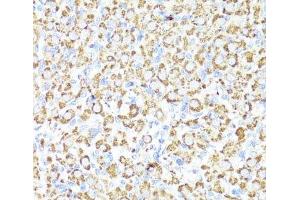 Immunohistochemistry of paraffin-embedded Rat ovary using CYP3A4 Polyclonal Antibody at dilution of 1:100 (40x lens). (CYP3A4 抗体)