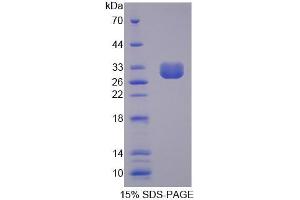 SDS-PAGE analysis of Human CLCA1 Protein. (CLCA1 蛋白)