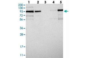 Western blot analysis of Lane 1: RT-4, Lane 2: U-251 MG, Lane 3: Human Plasma, Lane 4: Liver, Lane 5: Tonsil with LRCH1 polyclonal antibody  at 1:250-1:500 dilution. (LRCH1 抗体)