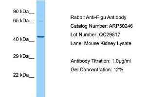 Western Blotting (WB) image for anti-Phosphatidylinositol Glycan Anchor Biosynthesis, Class U (PIGU) (N-Term) antibody (ABIN2784115) (PIGU 抗体  (N-Term))