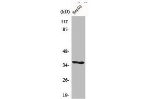 Western Blot analysis of LOVO cells using CA VI Polyclonal Antibody (CA6 抗体  (C-Term))