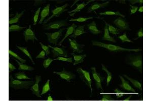 Immunofluorescence (IF) image for anti-Ribosomal Protein S6 Kinase, 90kDa, Polypeptide 5 (RPS6KA5) (AA 271-370) antibody (ABIN522729)