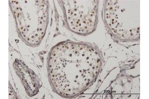 Image no. 3 for anti-Interferon Regulatory Factor 5 (IRF5) antibody (ABIN6745988) (IRF5 抗体)