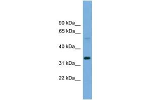WB Suggested Anti-TM7SF4  Antibody Titration: 0. (Transmembrane 7 Superfamily Member 4 (TM7SF4) (N-Term) 抗体)