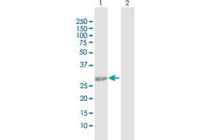 Western Blot analysis of AK2 expression in transfected 293T cell line by AK2 MaxPab polyclonal antibody. (Adenylate Kinase 2 抗体  (AA 1-239))
