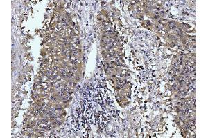 IHC analysis of Glutaminase/GLS using anti-Glutaminase/GLS antibody (ABIN7601601).