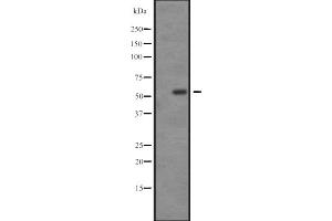 Western blot analysis of SGK3 expression in U-87 MG whole cell lysate ,The lane on the left is treated with the antigen-specific peptide. (SGK3 抗体  (C-Term))