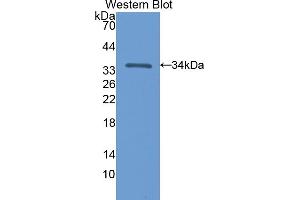 Western blot analysis of the recombinant protein. (NT5C3 抗体  (AA 1-297))