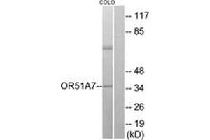 Western blot analysis of extracts from COLO cells, using OR51A7 Antibody. (OR51A7 抗体  (AA 232-281))