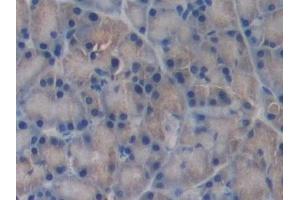 Immunohistochemistry (IHC) image for anti-Proteasome (Prosome, Macropain) Subunit, beta Type, 8 (Large Multifunctional Peptidase 7) (PSMB8) (AA 80-261) antibody (ABIN7440281)