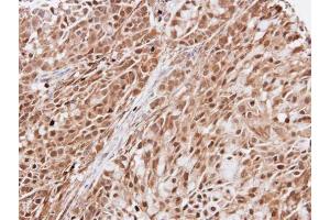 IHC-P Image Immunohistochemical analysis of paraffin-embedded A549 xenograft, using KIAA0494, antibody at 1:100 dilution. (KIAA0494 抗体  (Center))