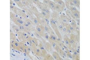 Immunohistochemistry of paraffin-embedded Human liver using PTTG1 Polyclonal Antibody at dilution of 1:100 (40x lens). (PTTG1 抗体)