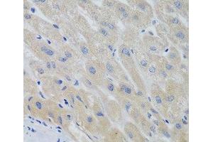 Immunohistochemistry of paraffin-embedded Human liver using PTTG1 Polyclonal Antibody at dilution of 1:100 (40x lens). (PTTG1 抗体)