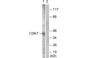 Immunohistochemistry analysis of paraffin-embedded human breast carcinoma tissue using CDK7 (Ab-170) antibody. (CDK7 抗体  (Thr170))