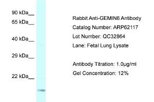 Western Blotting (WB) image for anti-Gem (Nuclear Organelle) Associated Protein 6 (GEMIN6) (Middle Region) antibody (ABIN2789026) (GEMIN6 抗体  (Middle Region))