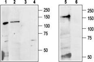 Western blot analysis of Colo205 (lanes 1 and 3), rat liver (lanes 2 and 4) and mouse kidney (lanes 5 and 6) lysates: - 1,2,5. (CASR 抗体  (Extracellular, N-Term))