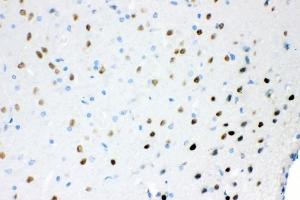 IHC analysis of Ataxin 1 using anti-Ataxin 1 antibody (ABIN3043506).
