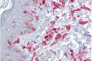 Immunohistochemistry with Skin, dermal fibroblasts tissue at an antibody concentration of 5µg/ml using anti-ZFP36L2 antibody (ARP33383_P050) (ZFP36L2 抗体  (N-Term))