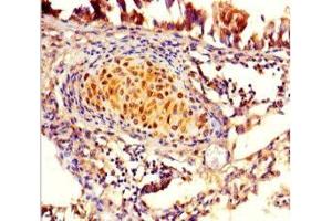 Immunohistochemistry of paraffin-embedded human lung tissue using ABIN7165430 at dilution of 1:100 (FAM161A 抗体  (AA 1-300))