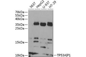 Western blot analysis of extracts of various cell lines, using TP53 antibody (ABIN6130604, ABIN6149410, ABIN6149412 and ABIN6218410) at 1:1000 dilution. (TP53AIP1 抗体  (AA 1-108))