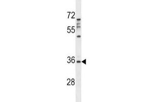 Aurora-C antibody western blot analysis in MDA-MB231 lysate. (Aurora Kinase C 抗体  (AA 3-38))