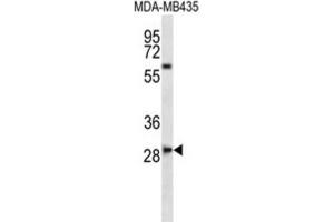 Western Blotting (WB) image for anti-SLAM Family Member 8 (SLAMF8) antibody (ABIN2997003) (SLAMF8 抗体)