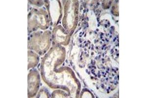 Formalin fixed, paraffin embedded human kidney tissue stained with STIM2 Antibody (N-term) followed by peroxidase conjugation of the secondary antibody and DAB staining. (Stim2 抗体  (N-Term))