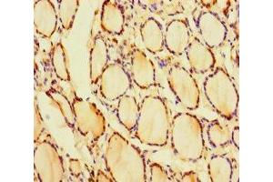 Immunohistochemistry of paraffin-embedded human thyroid tissue using ABIN7153535 at dilution of 1:100 (CRYGN 抗体  (AA 1-182))