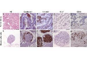 Immunohistochemical staining of tumor biopsy and biopsy spheroid sections.