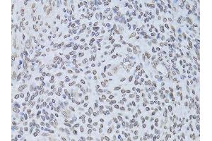 Immunohistochemistry of paraffin-embedded human adenomyosis using LMNB2 Antibody.