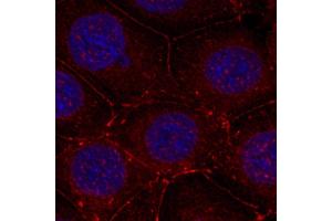 Immunofluorescence staining of methanol-fixed MCF7 cells using Phospho-IGF1R-Y1161 antibody. (IGF1R 抗体  (pTyr1161))