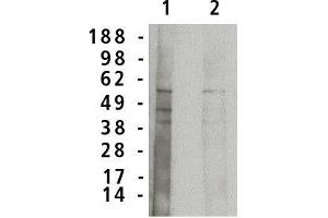 Western blot analysis using acid  sphingomyelinase antibody on normal human brain lysate (7 µg/lane). (SMPD1 抗体)