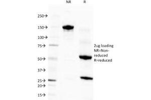 SDS-PAGE Analysis of Purified, BSA-Free Eosinophil Peroxidase Antibody (clone EPO104). (EPX 抗体)