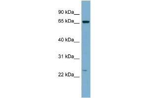 WB Suggested Anti-ZNF572 Antibody Titration:  0. (ZNF572 抗体  (Middle Region))
