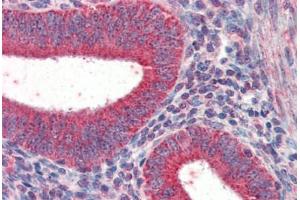 Human Uterus (formalin-fixed, paraffin-embedded) stained with TRIM5 antibody ABIN337284 at 5 ug/ml followed by biotinylated anti-goat IgG secondary antibody ABIN481715, alkaline phosphatase-streptavidin and chromogen. (TRIM5 抗体  (AA 2-15))