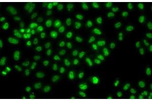 Immunofluorescence analysis of HeLa cells using LHX8 Polyclonal Antibody (LHX8 抗体)