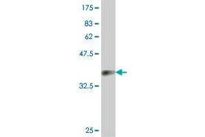 Western Blot detection against Immunogen (36. (SPG21 抗体  (AA 211-306))