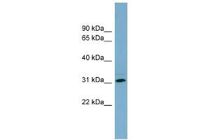 WB Suggested Anti-RNF144B Antibody Titration:  0. (RNF144B 抗体  (Middle Region))