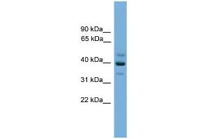 WB Suggested Anti-BNIPL Antibody Titration: 0. (BNIPL 抗体  (Middle Region))