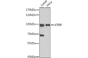 Western blot analysis of extracts of various cell lines, using ATRIP antibody (ABIN1678799, ABIN3019346, ABIN3019347 and ABIN6220835) at 1:1000 dilution. (ATRIP 抗体  (AA 1-260))