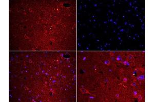 Formalin-fixed and paraffin embedded rat brain labeled with Rabbit Anti-Fibrinogen alpha chain Polyclonal Antibody, Unconjugated used at 1:200 dilution for 40 minutes at 37°C. (FGA 抗体  (AA 61-160))