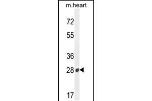 Western blot analysis in mouse heart tissue lysates (35ug/lane). (B3GAT2 抗体  (AA 123-150))