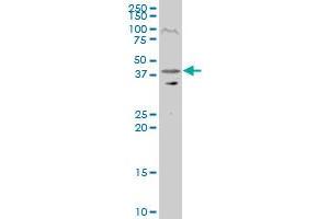RRAGC polyclonal antibody (A01), Lot # 050801JC01 Western Blot analysis of RRAGC expression in Y-79 . (GTR2 抗体  (AA 1-399))
