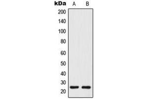 Western blot analysis of Tetraspanin 8 expression in human colon (A), COLO205 (B) whole cell lysates.