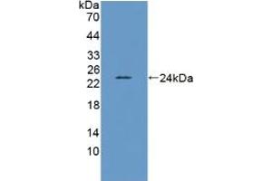 Western blot analysis of recombinant Mouse LEPR. (Leptin Receptor 抗体  (AA 22-203))