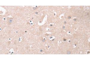 Immunohistochemistry of paraffin-embedded Human brain tissue using CDCA4 Polyclonal Antibody at dilution 1:50